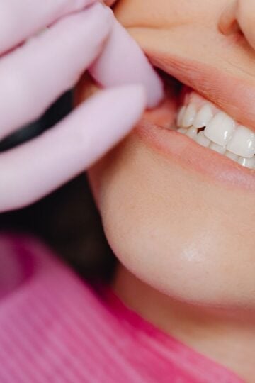 A person at a dental examination, wearing a pink serviette, has their cheek gently pulled back by a gloved hand, revealing clean teeth and gums free of dental problems, highlighting good oral health.