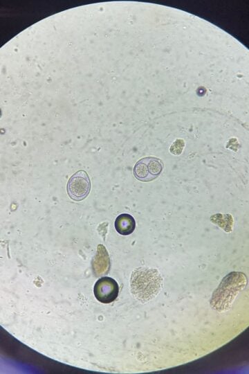 Microscopic view of a slide showing various round cells and particles scattered across a light background.