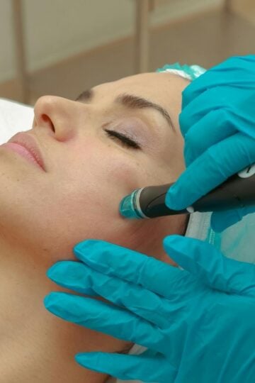 A person receives an advanced aesthetic treatment from a professional wearing blue gloves, using a handheld device on the cheek at a medical spa in Coral Gables.