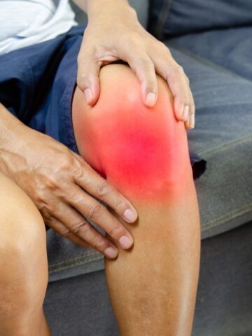 A person sitting on a sofa holds their knee, which appears red and inflamed, suggesting pain or swelling from a possible meniscus tear.